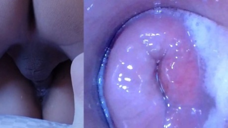 Pussy cum, Pussy cam!! (Endoscope inside creampied pussy)